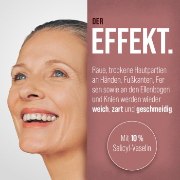 Hornhaut-Salbe 90 g